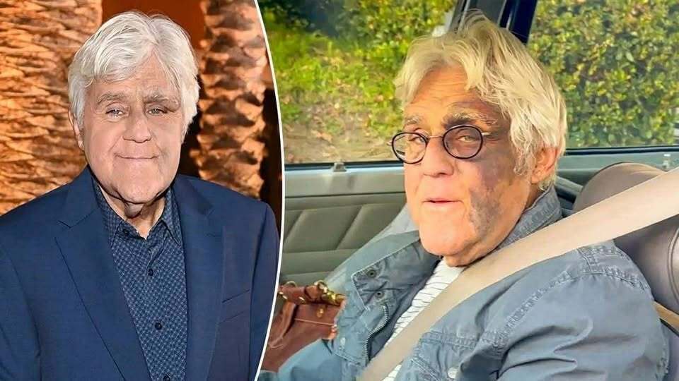 It breaks our hearts to confirm the news about the great Jay Leno, 74