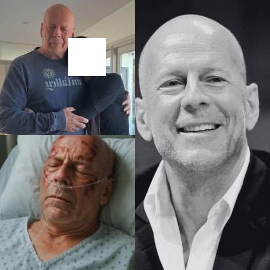Family confirmed that former actor Bruce Willis had!!!