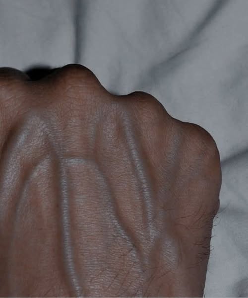 If your veins are visible in your hand, it is a signal of ca, See more!