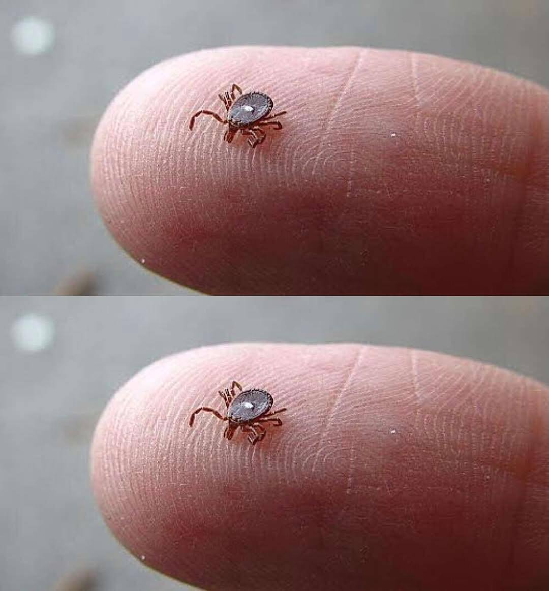 Lone Star Tick Bite: What It Means and What You Must Do Immediately