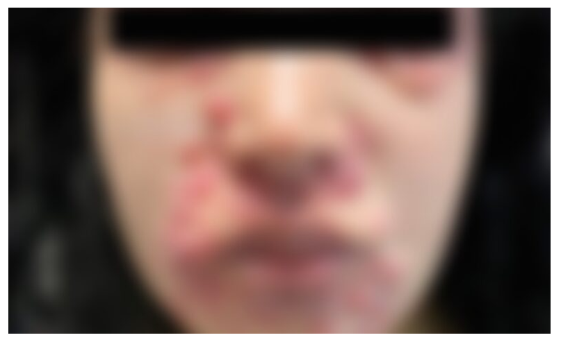 Genital Skin Changes! When to Worry and When to Relax