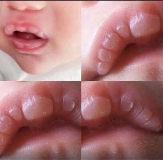 If your baby has these marks here is what it means