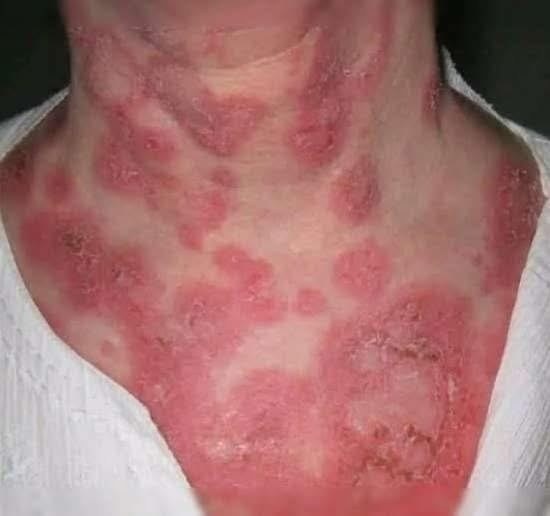 Urgency – These are the consequences of sleeping co! See more – SOTD!